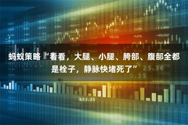 蚂蚁策略 “看看,大腿、小腿、胯部、腹部全都是栓子,静脉快堵死了”